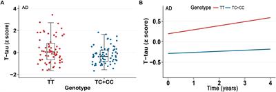 TREML2 Mutation Mediate Alzheimer’s Disease Risk by Altering Neuronal Degeneration